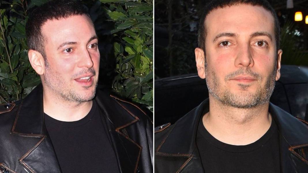 Oğuzhan Koç'u gören Nihat Doğan sandı! Yaptırdığı estetik sosyal medyayı salladı: Yazık olmuş 4